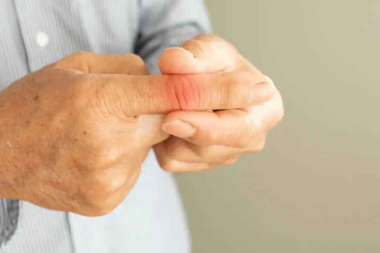 Sokízületi gyulladás (polyarthritis)