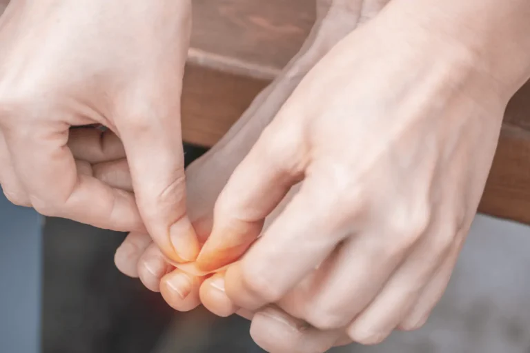 Begyulladt köröm eltávolítása sebészeti úton a Lotusz Medical Centerben Budapesten.